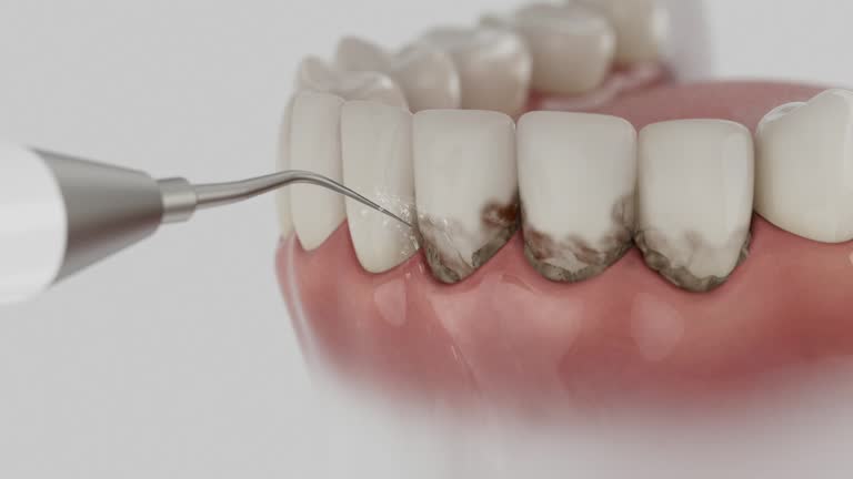 Reliable Tooth Extraction contractor in Delta County County, TX by Dentist Open Now